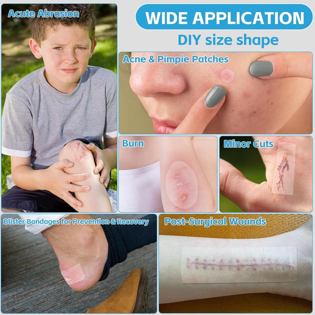 hydrocolloid-bandages-for-wound-care-ext-3.jpg
