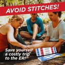 clozex-emergency-laceration-closures---r-2.jpg