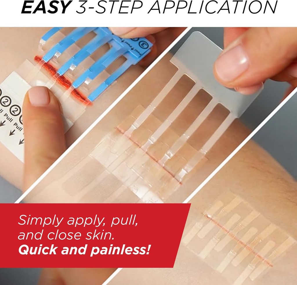 clozex-emergency-laceration-closures---r-5.jpg